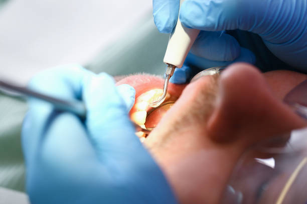Best Cracked Tooth Emergency Dentist  in Parma Heights, OH