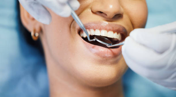 Best Dentist for Tooth Abscess  in Parma Heights, OH