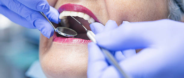 Best Cracked Tooth Emergency Dentist  in Parma Heights, OH